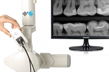 Radiologie Dentara Digitala